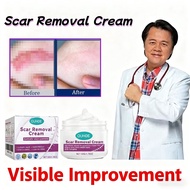 OUHOE Scar Removal Cream Peklat Remover Acne Treatment Scar Remover Cream Stretch Mark Cream