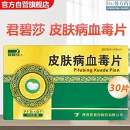 新品现货君碧莎 皮肤病血毒片 0.5g*30片/盒 新效期 连锁房 放心好 多盒更优惠 国准字 皮肤病血毒片Junbi Sha Skin Disease Blood Toxin Tablets 0.5