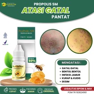 Obat Gatal Pantat Obat Pantat Burik Budug Borok Obat Gatal Selangkangan Obat Gatal Hitam Beruntusan