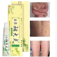 0intment/Sal3p Chy*gao For Kul1t 100% Original Ad@ BARC0DE