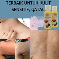 sabun dani kulit gatal/kurap/panau/kudis/exzema