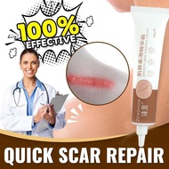 20g Scar Removal Cream Acne Scar Remover For Old New Scar Face Body Skin Repair Strech Mark Removal 