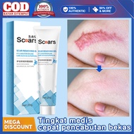 scar cream acne scar acne scar treatment scar removal 20g Proliferative scars Burn scars Keloid fadi