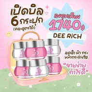 Open A Bill 6 Jars Can Mix 1