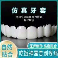 Pendakap gigi makan artifak lelaki tua gigi palsu sementara simulasi gigi buck gigi hilang penutup celah gigi depan pele