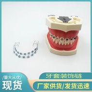 Fashion Brace Fashion Braces Oral Braces Decorative Braces Decorative Chain Braces Complete Color Fa