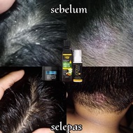 SET LENGKAP RAWATAN RAMBUT HSF NATURAL