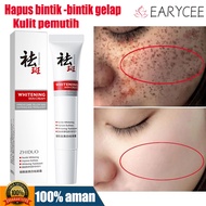 Whitening Blemish Flek Hitam Penghilang Flek Hitam Ori Anti Freckle Salep Melasma Dark Spot Pemutih 