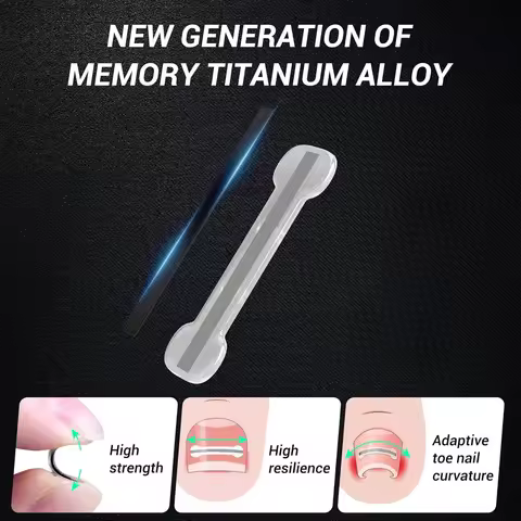 Pedicure Recover Embed Toe Nail Professional Ingrown Toenail Straightening Clip Brace 2Pcs Ingrown T