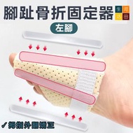 河田生活 - 腳趾骨折鋁合金板條固定器(大腳趾款-左腳) | 拇指外翻矯正| 腳趾保護套|分趾器