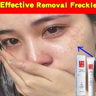 Whitening Cream Dark Spot Remover Freckle Removal Cream Pigmentation Remove Cream 20g 美白祛斑霜