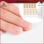 [SONONIA] Ingrown Toenail Correction Kit Foot Care Pedicure Tools, Ingrown Toenail Correction Patch