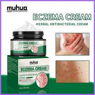 Cross-border E-commerce AliExpress Lazada  ECZEMA CREAM Shiduqing Ointment