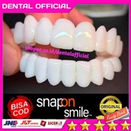 SNAP ON SMILE GIGI PALSU TERLARIS 100 ORIGINAL - VENNER GIGI diskon