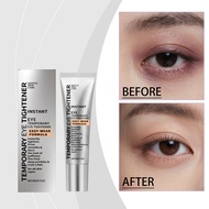 Amz Eye Care Cream Gentle Formula Eye Cream Moisturizes the Skin Around the Eyes. Gently Mage the Sk
