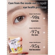 Eye Care Solution Vision Eye Drops Lutein Relief Blurred Vision
