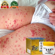 bai yao lang cream original Eczema Psoriasis cream Antifungal cream Ubat gatal kulit krim gatal kuli