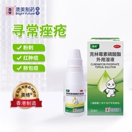 Aolo's anti-acne partner clindamycin phosphate topical solut奥络战痘搭档克林霉素磷酸酯外用溶液30ml用于寻常痤疮zq12.3