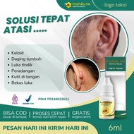 Obat Keloid Obat Keloid Luka Tindik Keloid Daging Tumbuh Keloid di Telinga Obat Penghilang Bekas Tin