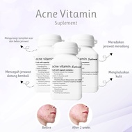 Ms Glow Acne Vitamin Supplement