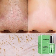 New LANBENA Blackhead Remover Serum + Shrinks Pore Serum (Step 1+Step 2) Facial Acne Treatment 17ml 