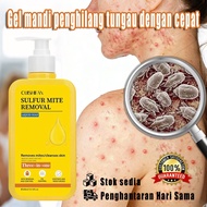 Body acne body wash clearlab sulfur body wash eczema body wash sulfur body wash sabun sulfur untuk g