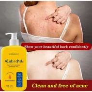 300ml Sulful Soap Body Soap Medicated Soap Body Soap Removing Mites Anti Itching Body Soap shower ge