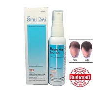 Reten Five รีเทน ไฟว์ ขนาด 60 ml สำหรับปัญหาผมร่วง ล้านบาง ฉีดพ่นสเปย์บนหนังศรีษะ โดยไม่ต้องล้างออก