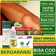 Lipoma Herbal Medicine | Lipoma Benjolan Benjolan Medicine | Lipoma Benjolan Filler | Propolis SM