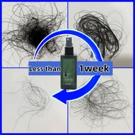 New Hair Lotion Spray Hair Growth Spray Hair Loss Treatment Anti Hair Loss Hair Regrowth Hair Care H