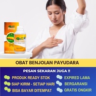 Obat Pengempes Benjolan Payudara Akibat Tumor Jinak Abses Mastitis Kista Fibroadenoma Kanker Payudar
