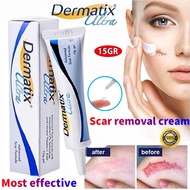 Dermatix Ultra Scar Gel 15g Dermatic Acne Scar Reduction Cream Advance Gel Reduce Deep Scars & Post-