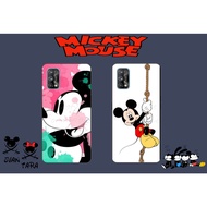 Realme Note 80 60X 60 50 GT 8 Pro GT 7 Pro 7T 6T 6 3 3T 2 GT Master Edition C25 C12 Mickey Mouse Pho