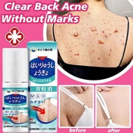 Japanese anti acne body spray back acne removal 60ml Rawatan jerawat badan cepat acne scar removal s