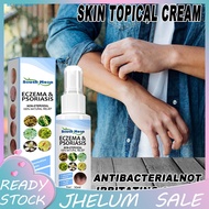 Atl| Eliminate Itching Eczema Spray Psoriasis Eczema Care Spray Natural for External Use