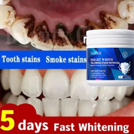 Teeth Whitening Powder 50g / Whitening Tooth Powder /Pemutih Gigi Teeth Whitening Powder - Mencerahk