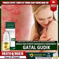 Obat Gudikan Gudik Di Siku Gudik Di Ketiak Gudik Di Penis Gudik Di Puting Susu Gudik Di Sela Jari Gu