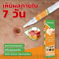 แถมฟรี!แผ่นแปะหูดติ่งเนื้อ24ชิ้น ของแท้100% หูดตาปลาติ่งติ่งเนื้อ ขี้แมลงวัน ครีมแต้มหูด ไฝ ปลอดภัยไ