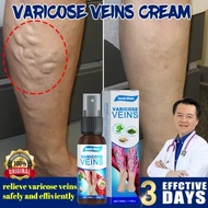 50g Varicose Veins Spray Obat Varises Salep Penghilang Varises Vaskulitis / Parises Ampuh Tanpa Oper