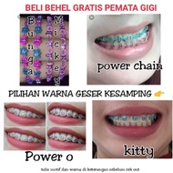 [FREE SHIPPING] Removable Braces Removable Fashion Braces/ Upper and lower braces only