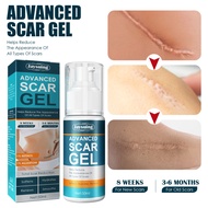 50ml Advanced Scar Removal Cream Ac-ne Pimples Stretch Marks Repair Gel Burn Sur-gical Scar Treatment Smoothing Body Beauty Care