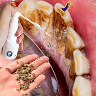 Plaque & Tartar Removal Spray – Teeth Whitening, Bad Breath Treatment, Yellow Stain Remover | Anti-C