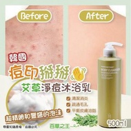 韓國痘印掰掰艾草淨痘沐浴乳 預購