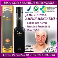 Obat Lupus Ampuh Lupus Imuran Lupus tnb Untuk Penyakit Lupus Herbal Lupus Gatal Gatal Merah Ruam Di 