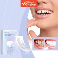 Teeth Whitening Strips, Easy Home Use Oral Hygiene Solution, Fresh Feeling, Visible Whitening Effect