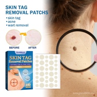 West & Month West & Month Warts Remove Meat Pellets Flat Warts Sharp Warts Skin Repair Gram Warts