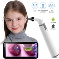 Wireless HD WIFI Visual Otoscope Ear Nose Dental Endoscope Camera Medical Ear Wax Cleaner Support IOS Android