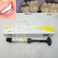 Veneer braces glue composite dental filling material veneer light cure laser dental composite