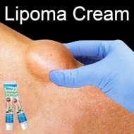 Original Lipoma Cream Removal of Subcutaneous Lipoma Eliminate Lipoma Mass Lipolysis Get Rid of Lipo