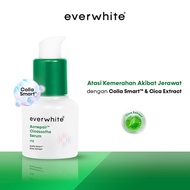 ♞,♘Everwhite Acnepair Cicasoothe Serum 20ml - Acne Serum for Acne-Prone Skin and Disguise the Appea
